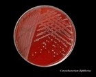 Corynebacterium diphtheriae on agar plate
